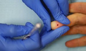 Homem vive mais de seis anos sem sinais do HIV ap&oacute;s transplante de c&eacute;lulas-tronco, indica estudo ace