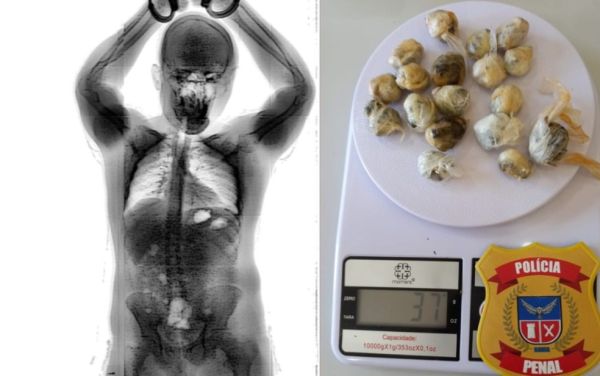 Brumado: Homem engole 18 por&ccedil;&otilde;es de maconha para entrar em pres&iacute;dio para sustentar v&iacute;cio.